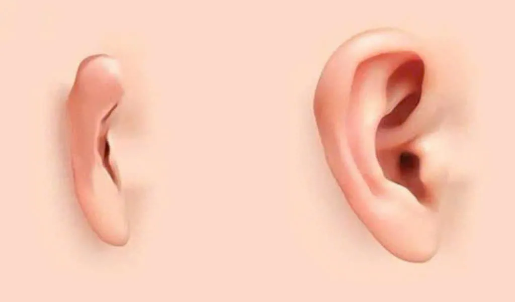 Đừng xem thường, tai không chỉ để nghe và xem tướng mà còn chẩn bệnh được  đấy