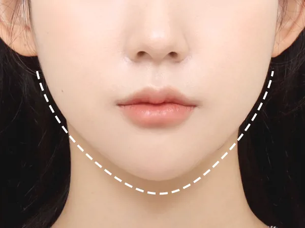 Luận giải tướng Cằm