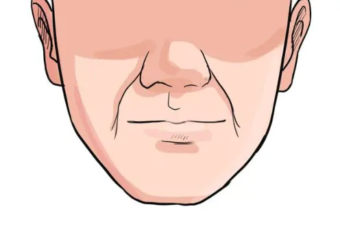 Dấu hiệu đường pháp lệnh trên khuôn mặt xuất hiện sớm trong Nhân Tướng Học