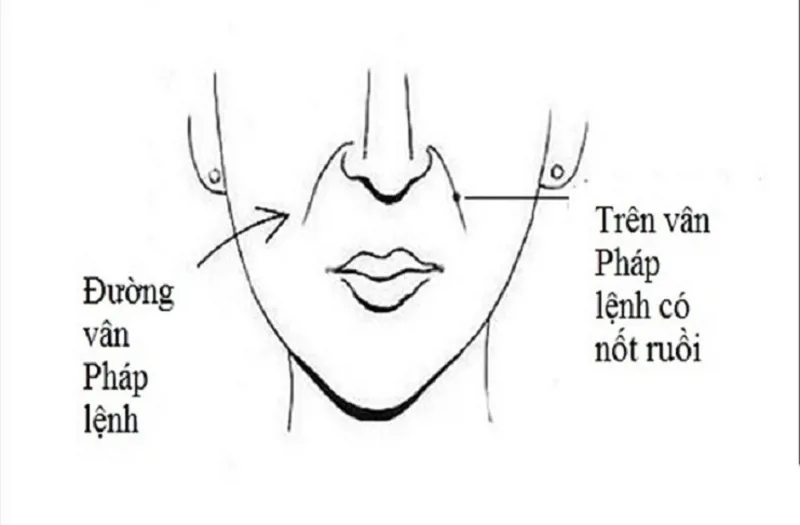 Ý nghĩa về nốt ruồi ở pháp lệnh trong Nhân Tướng Học