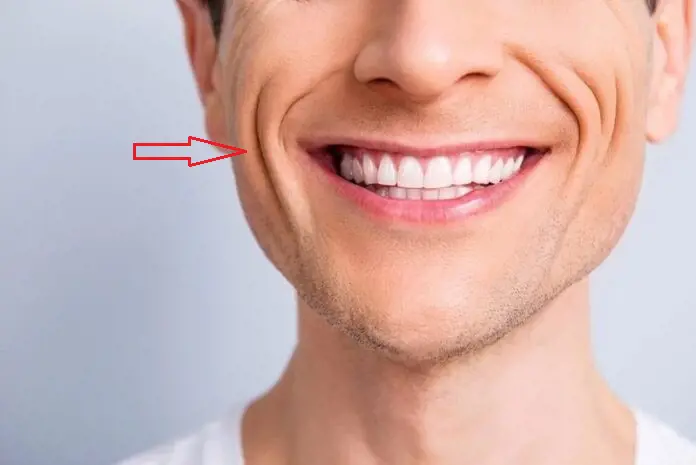 So sánh pháp lệnh đẹp và xấu, bao gồm pháp lệnh hình chuông và pháp lệnh đứt đoạn