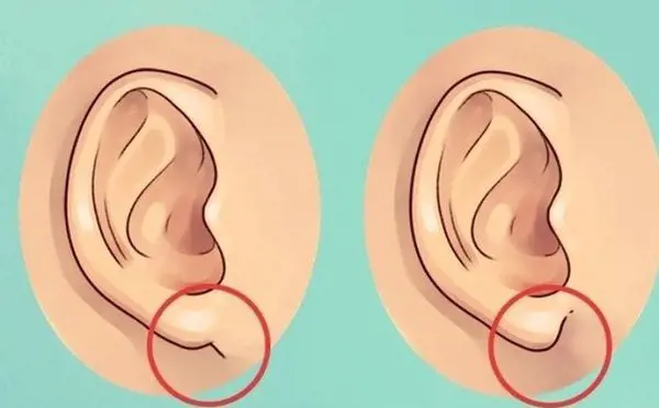 Phân tích các tướng tai: tai to và dái tai đầy đặn