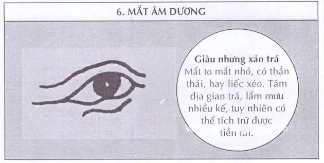 Cận cảnh đôi mắt âm dương với khác biệt kích thước và lòng trắng