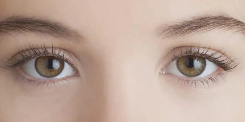 Ví dụ mắt cười hình trăng khuyết trên khuôn mặt phụ nữ