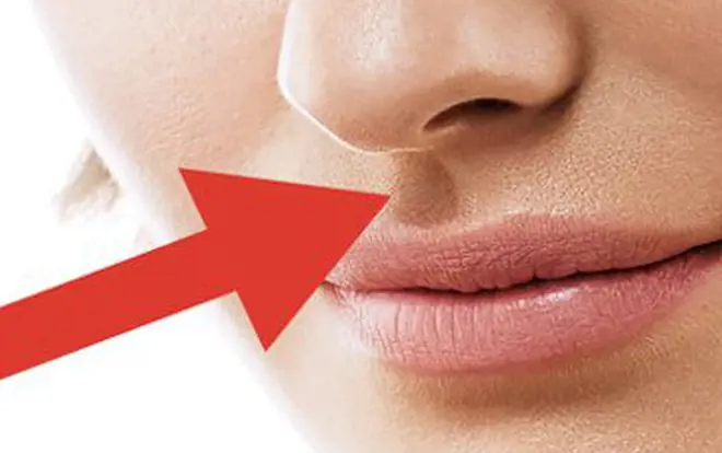 Minh họa nhân trung ngắn nhân tướng trên khuôn mặt thực tế