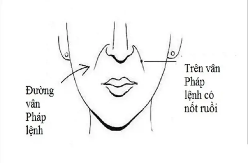 Nốt ruồi ở đường pháp lệnh: ý nghĩa bên trái, bên phải ở nam và nữ
