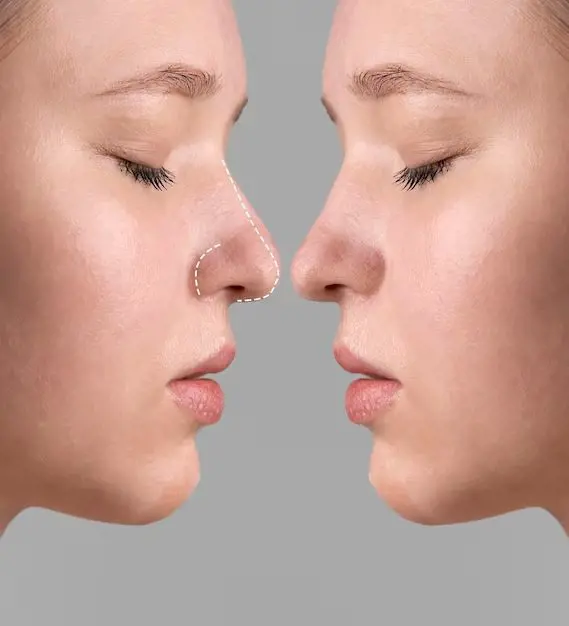 Sơn căn cao thấp nhân tướng: phân biệt, ý nghĩa và cảnh báo sức khỏe