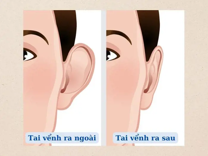 Luận tướng tai vểnh rõ liên quan phúc đức cung và tam đình