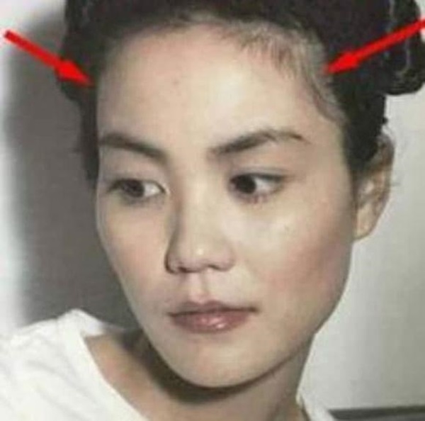 Trán cao có tốt không: Giải mã tướng trán thông minh và ảnh hưởng tới trí tuệ, tài vận