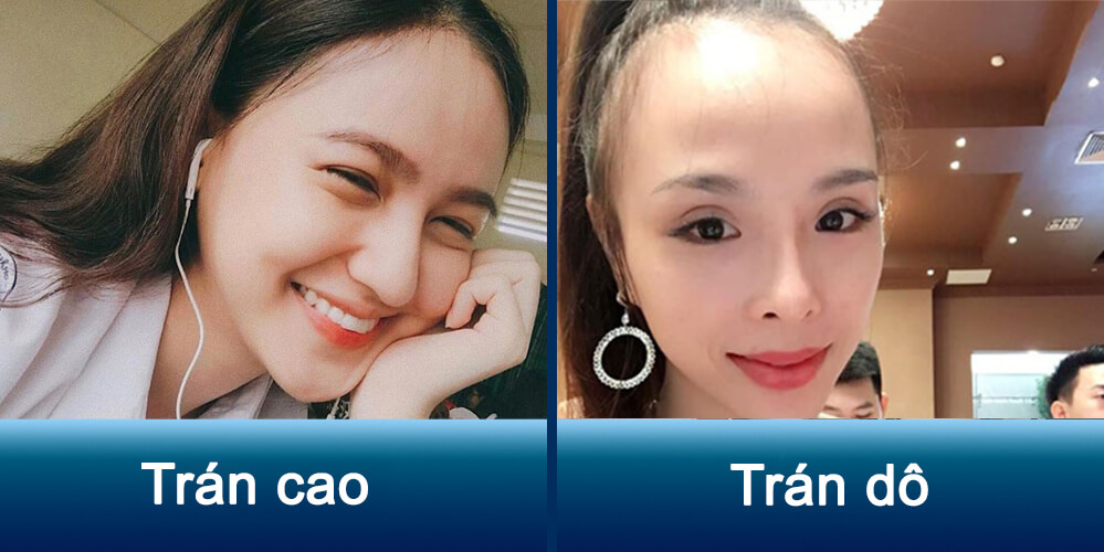 Trán cao trong nhân tướng học: Ý nghĩa tướng trán và ảnh hưởng đến vận mệnh, sự nghiệp