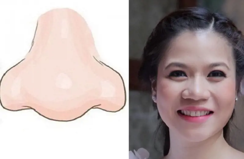 Tướng giàu sang: Có nên chỉ nhìn vào mũi hay cần nhìn tổng thể khuôn mặt?