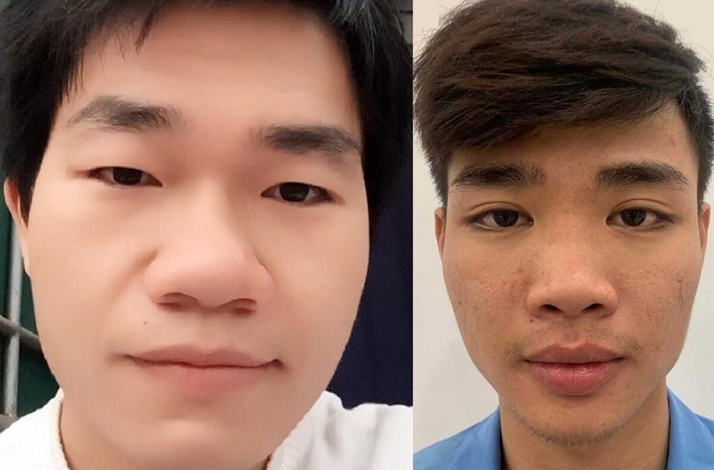 Tướng mũi trong nhân tướng học: Dấu hiệu tài lộc, tính cách và cách cải tướng hiệu quả