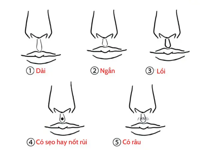 Hình ảnh cận cảnh nhân trung sâu và dài trên khuôn mặt nam