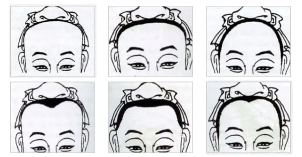 Hình ảnh ví dụ tướng trán chữ M và các vùng thượng đình trung đình